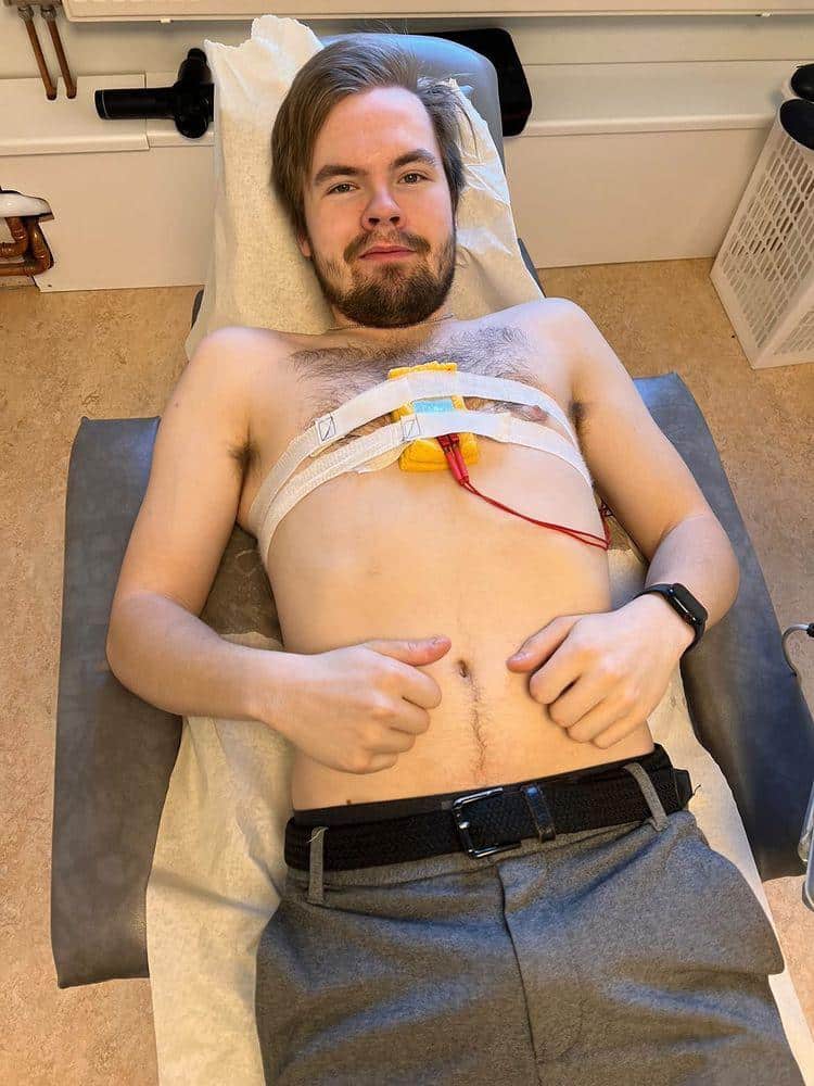 Jonathan från Luleå får elbehandling på bröstbenet efter en krasch med skotern