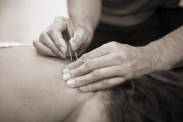 Akupunktur behandling utförs av en leg. naprapat.