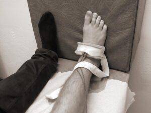 Legitimerad naprapat behandlar en idrottsskada med elbehandling på en fot