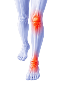 Smärta i knä, underben och fot